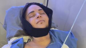 Rosanna Pansino Surgery: YouTuber Rosanna Pansino undergoes surgery after breaking jaw in boat accident