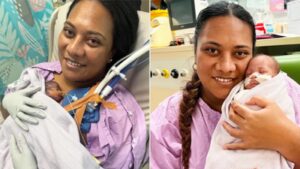 An Australian woman learned she was pregnant and could give birth ‘any day’ within 24 hours; her daughter arrived at 21 weeks 3 days and became the country’s most premature baby to survive