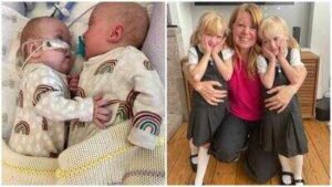 Mother of twin girls given less than 10% chance of survival after TTTS at 16 weeks; after surgery, premature birth and 300 days in hospital, twins now prepare for first day of school